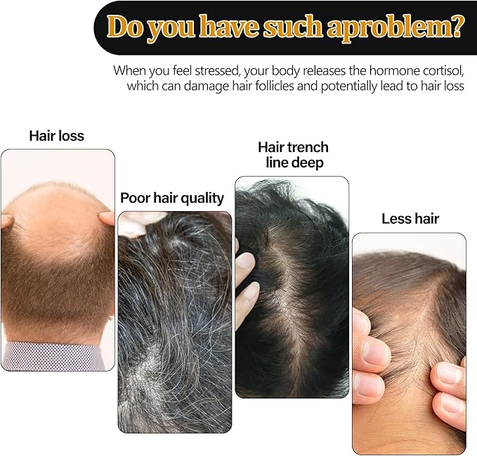 Eelhoe Hair Regrowth Shampoo